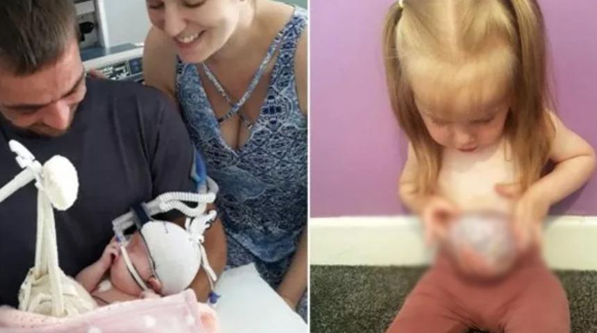 Küçük kız midesi, bağırsak ve karaciğeri dışarıda yaşıyor