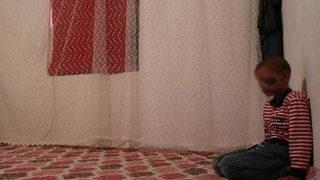 Cilt kanseri 8 yaşındaki Salih, gün ışığına çıkamıyor! Baba İğneci'den yetkililere çağrı