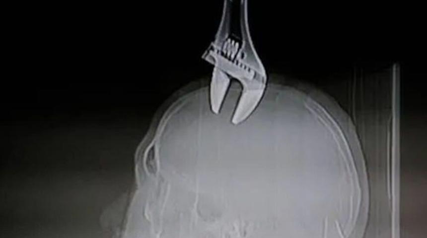 Yolda y&uuml;r&uuml;rken kafasına kurbağacık saplandı