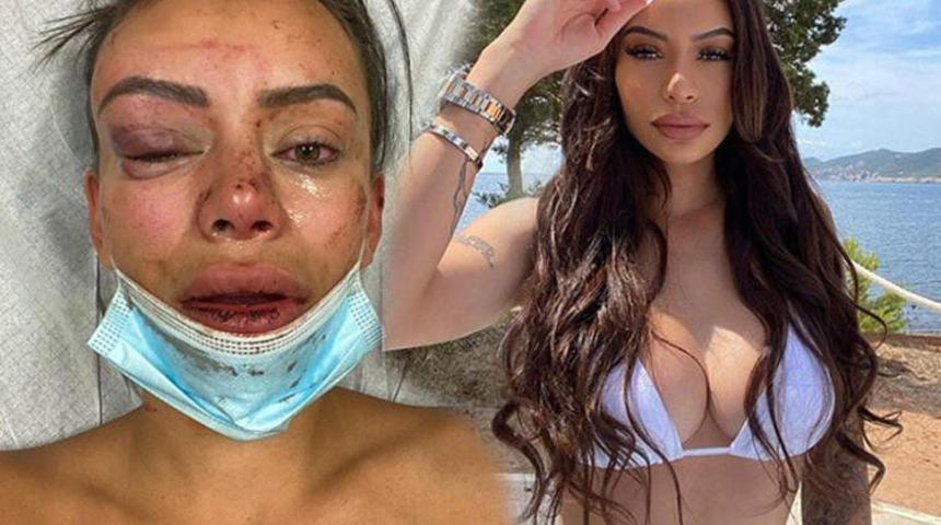 &Uuml;nl&uuml; model kendi evinde dehşeti yaşadı! 