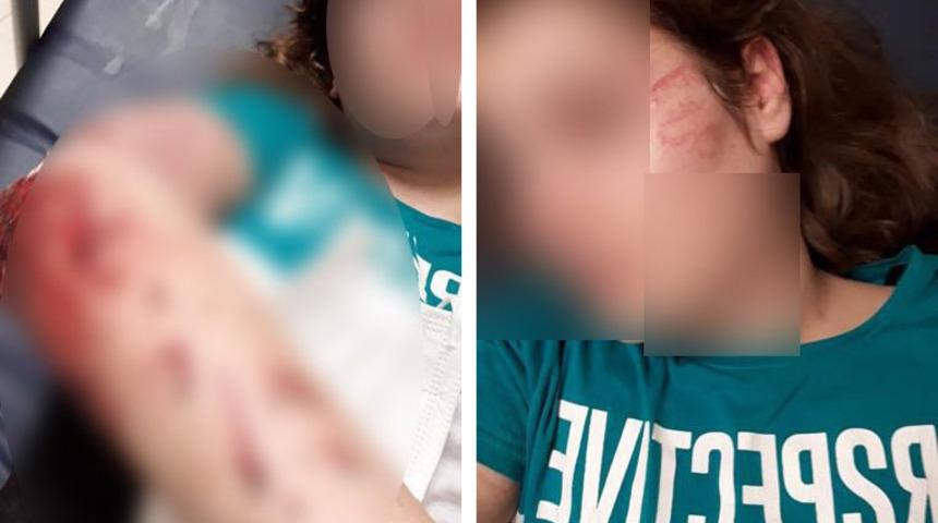 Ağabeyinin darp ettiği üniversiteli Ceylan, kendini ikinci kattan attı