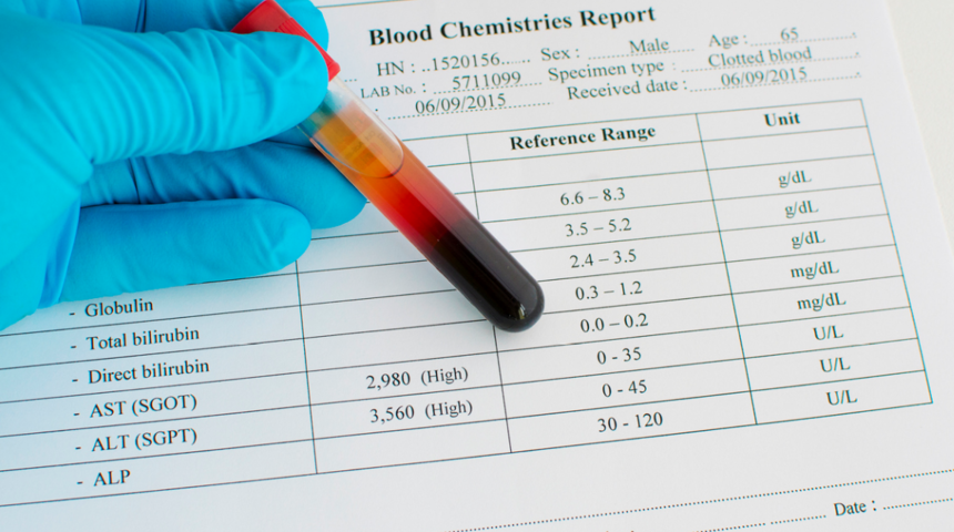 ALT nedir? ALT düşüklüğü, yüksekliği, normal değeri