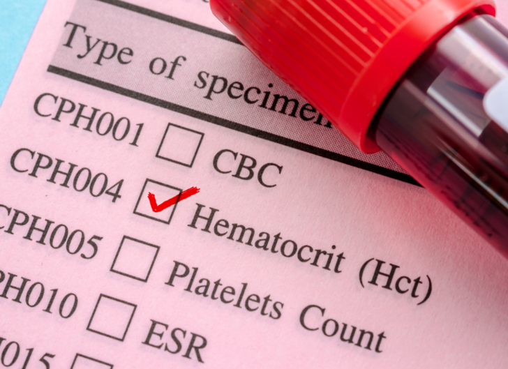 HCT (Hematokrit) nedir? HCT düşüklüğü, yüksekliği, normal değeri