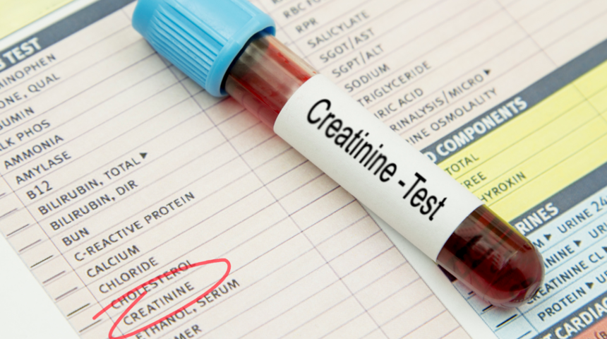 Kreatinin nedir? Kanda kreatinin d&uuml;ş&uuml;kl&uuml;ğ&uuml; ve y&uuml;ksekliği, normal değeri