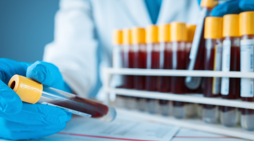 MCH nedir? MCH yüksekliği, düşüklüğü, normal değeri