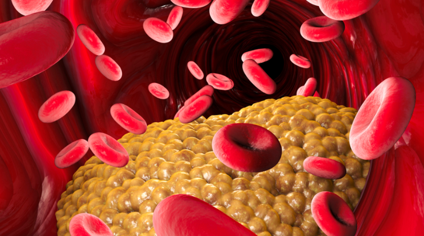 Trigliserid nedir? Trigliserid düşüklüğü, yüksekliği, normal değeri