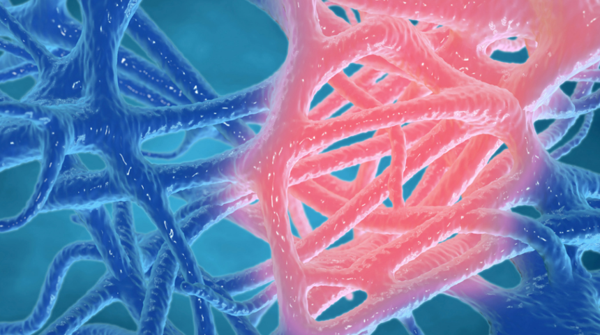 İltihap nasıl geçer? İltihap kurutucu bitkiler