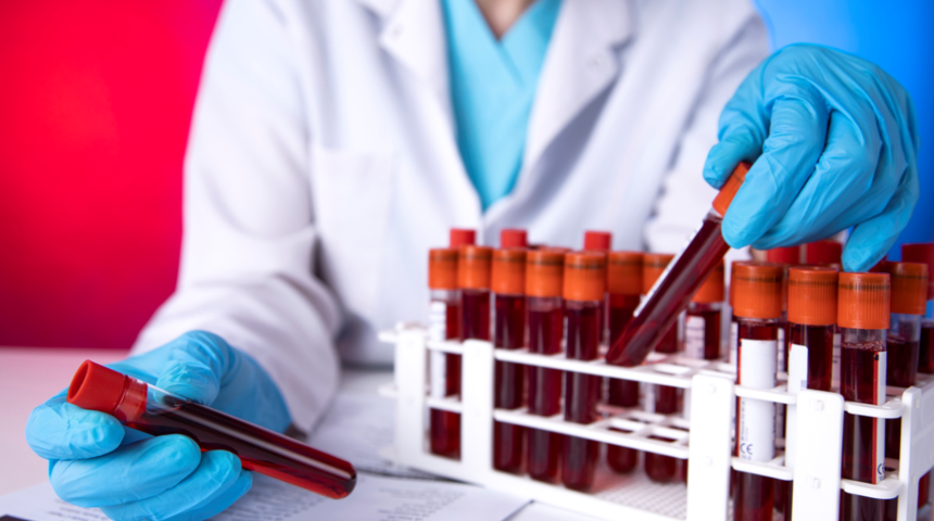 MCV nedir? MCV d&uuml;ş&uuml;kl&uuml;ğ&uuml;, y&uuml;ksekliği, normal değeri