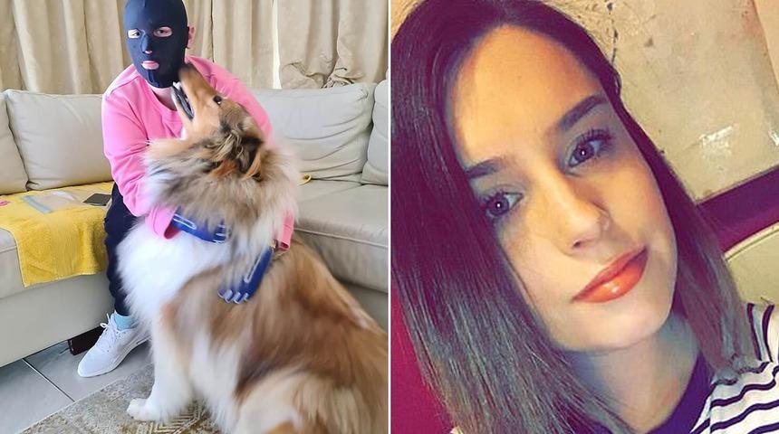 Korkun&ccedil;: Babası ve kız kardeşini kaybetti, v&uuml;cudunun %70&rsquo;i ağır yandı