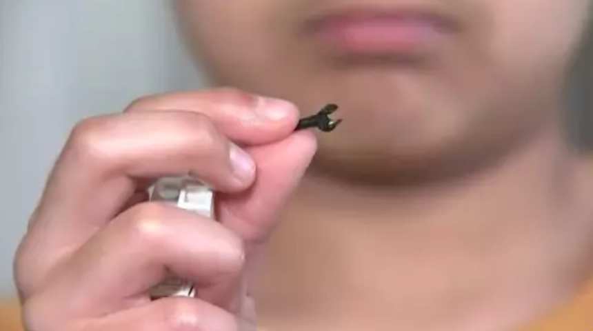 2 yıl boyunca burnunda Lego parçasıyla yaşadı