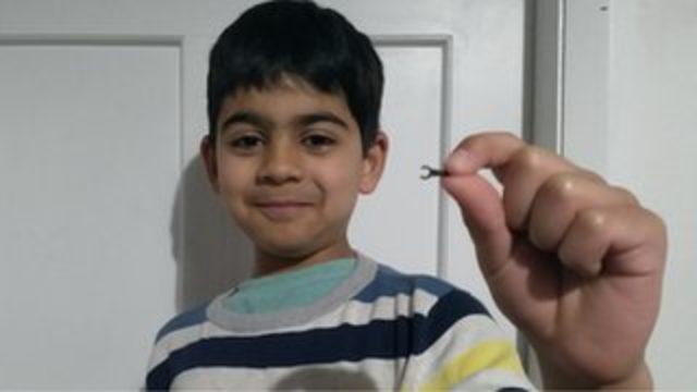 7 yaşındaki çocuğun burnuna kaçan Lego parçası 2 sene sonra düştü
