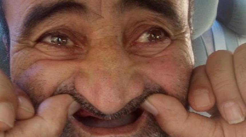 Ameliyat &ouml;ncesi teslim ettikleri altın dişler, başka hastaya verilmiş