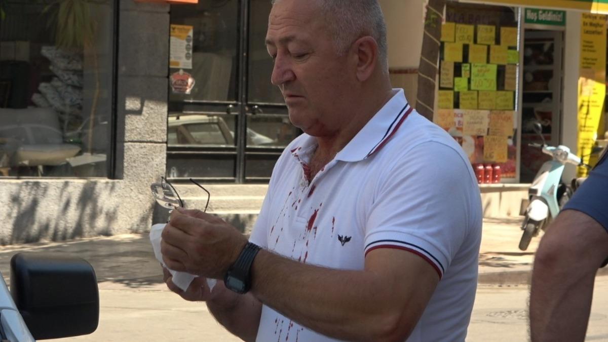 Kazada kafasını &ccedil;arpan s&uuml;r&uuml;c&uuml;n&uuml;n kıyafeti kan i&ccedil;inde kaldı