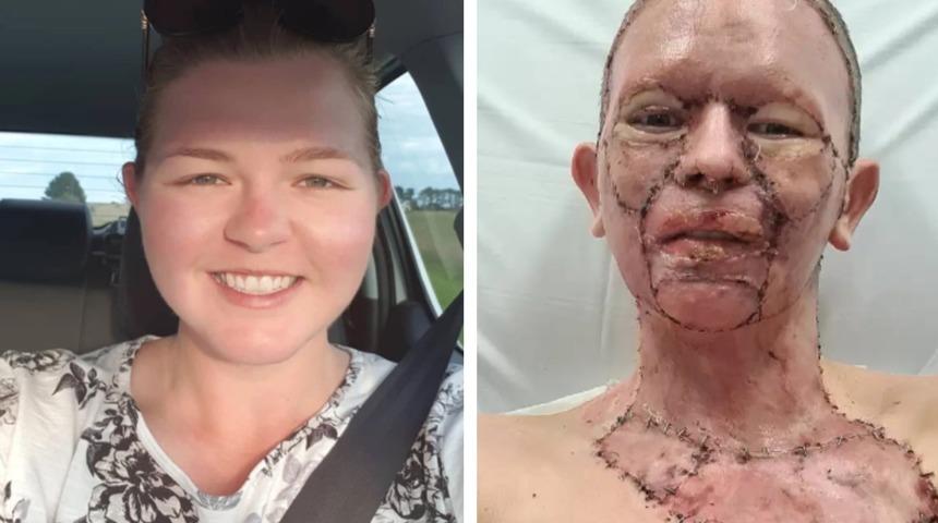 Uyuyakaldığı sandalye kamp ateşine devrildi!