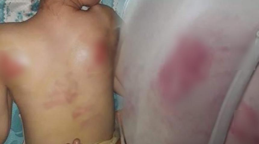 Tekirdağ'da dehşet! Kızını İngiliz anahtarıyla dövdü