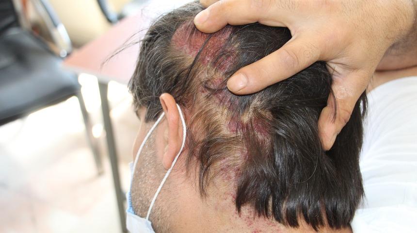 20 yıldır teşhis edilemeyen hastalığı hayatını kabusa &ccedil;evirdi