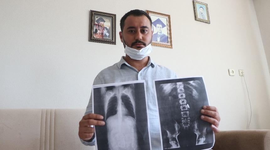 15 Temmuz gazisi 4 yıldır v&uuml;cudunda mermilerle yaşıyor