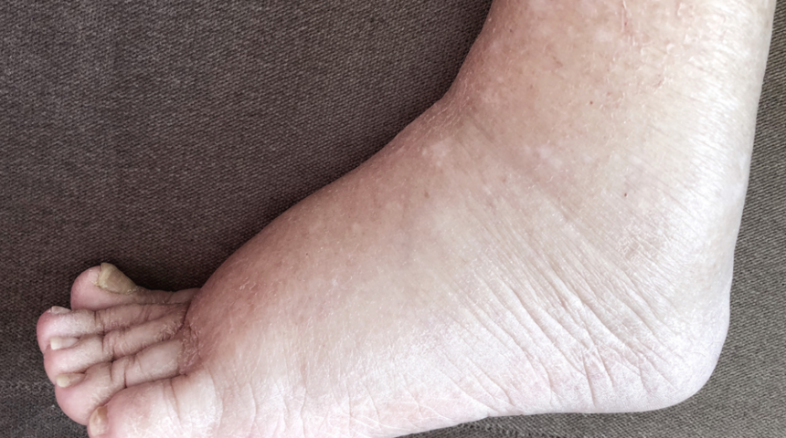 'Ne olacak ki?' demeyin! Bu belirtileri görmezden gelirseniz vücudunuzda olabilecekler...