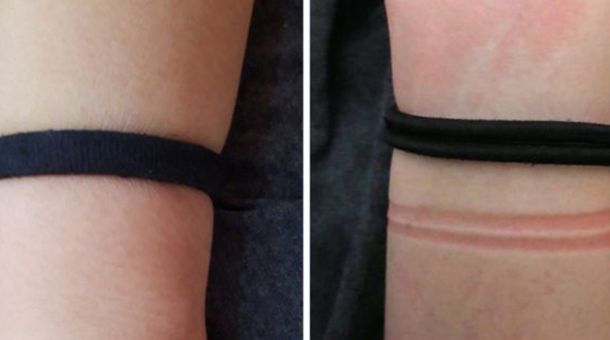 Bir daha denemeyin! Bileğinize neden saç lastiği takmamalısınız?
