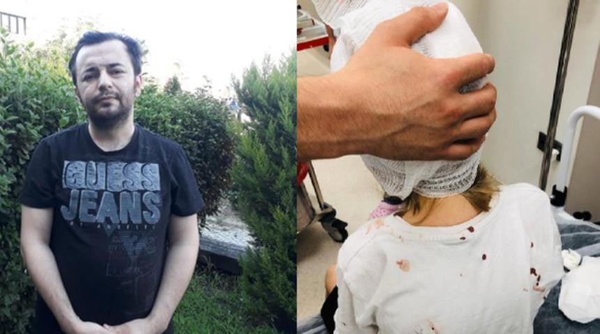 5 yaşındaki çocuğun kafatası delinmişti! Dehşet anlarını anlattı