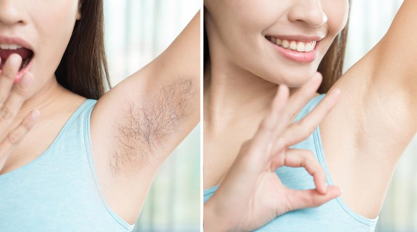 Bir ay boyunca koltuk altı t&uuml;ylerinizi almadığınızda bakın neler oluyor!