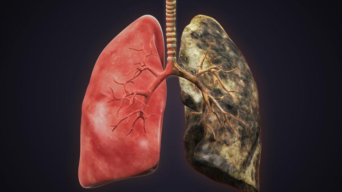 3 günde ciğerleri temizlemeye yardımcı olan akciğer detoksu - Sağlık  Haberleri