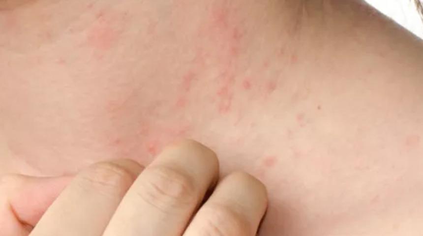 Meğer g&ouml;ğ&uuml;slerde kaşıntı bu y&uuml;zden oluşuyormuş! Eğer &ouml;nlem almazsanız...