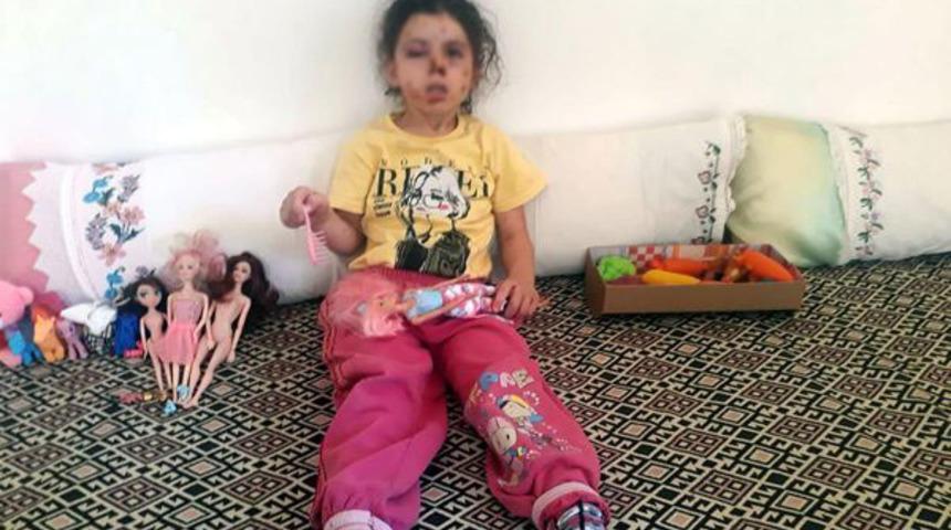 Yasak dinlemediler, konvoy yapıp havaya ateş a&ccedil;tılar! K&uuml;&ccedil;&uuml;k kız yaralandı, &ccedil;ok sayıda g&ouml;zaltı