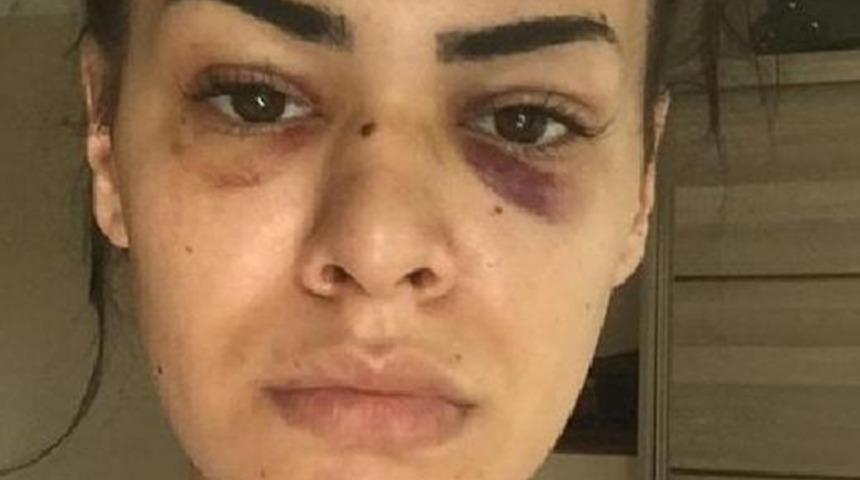 İstanbul'da genç kız dehşeti yaşadı: Önce tacize uğradı sonra darp edildi