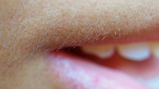 Yüz tüylerinden kurtulmanıza yardımcı olacak 5 basit yöntem