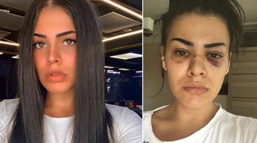 Bostancı'daki cinsel saldırı ve darp olayında yeni gelişme: Koruma isteyecek