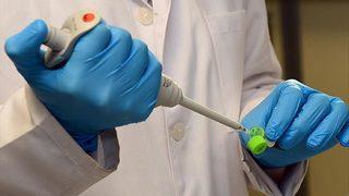 Kritik açıklama! 'Koronavirüs erkeklerde kısırlık yapabilir'