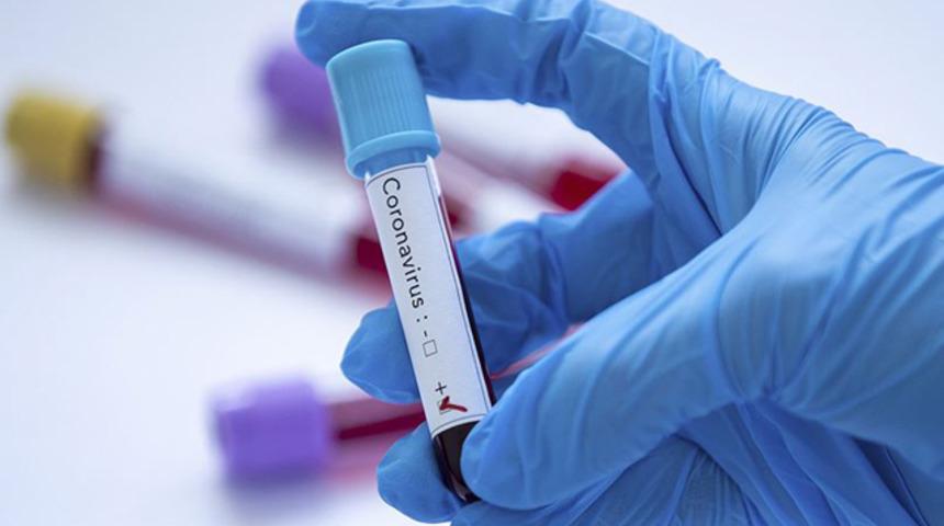 Galatasaray HDI Sigorta'da iki kişinin koronavir&uuml;s testi pozitif 