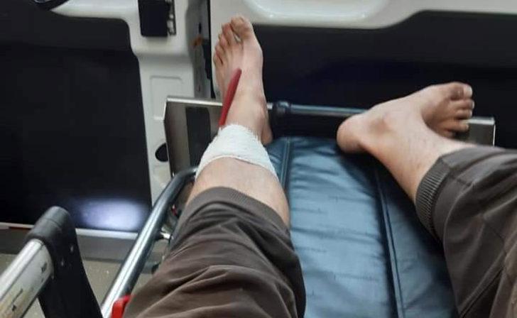 Koli bantlarken bı&ccedil;ak bacağına saplandı