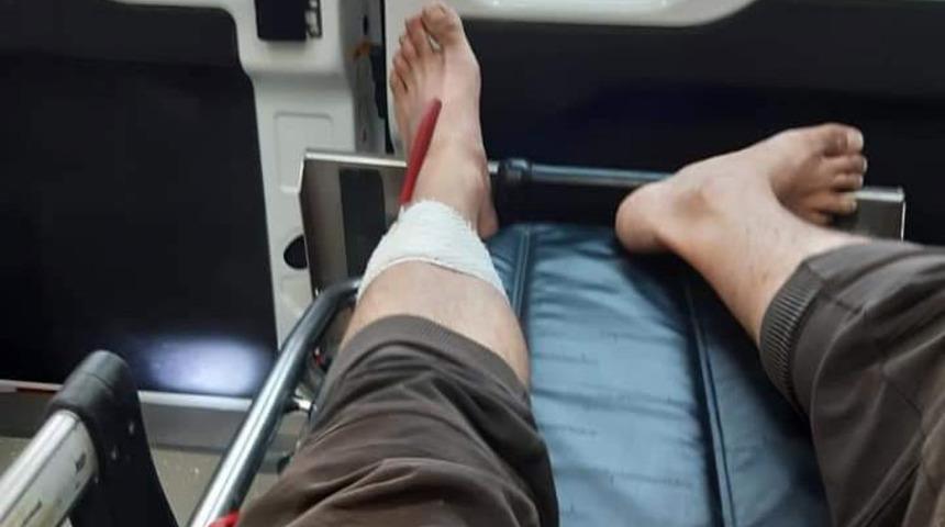 Koli bantlarken bıçak bacağına saplandı