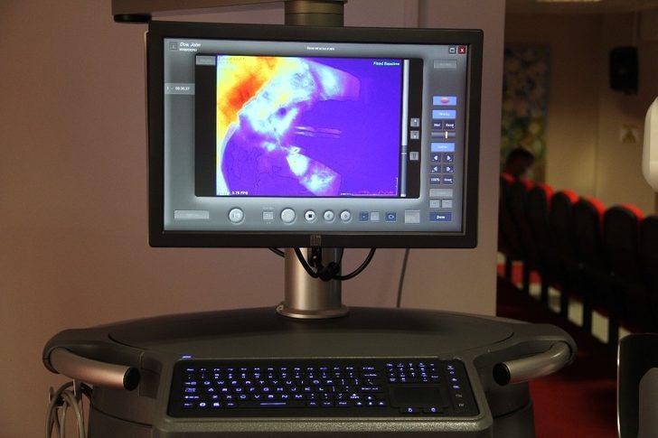 TİSK Mikrocerrahi ve Rekonstrüksiyon Vakfından MEÜ Hastanesine 800 bin TL’lik cihaz G4