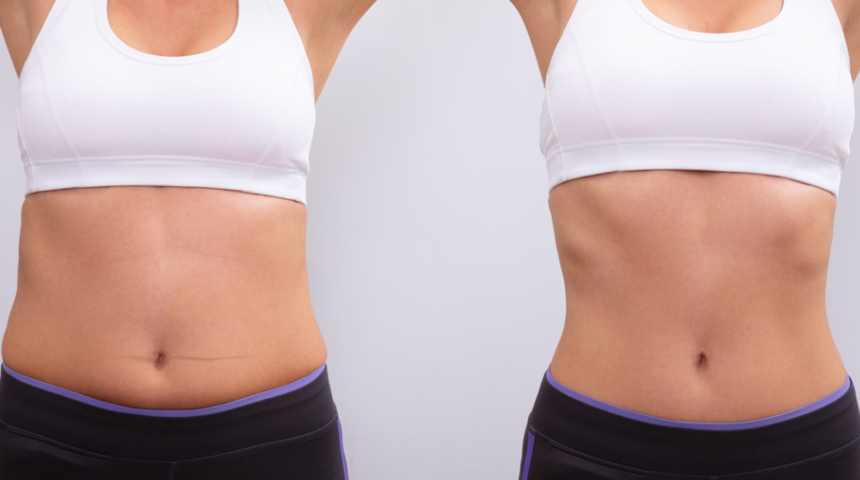 Hızlı ve fit görünüm için karın germe