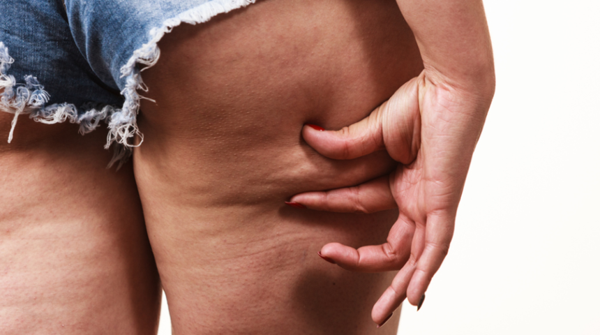 Sel&uuml;lit probleminden kurtulmanızı sağlayacak 7 mucize besin!