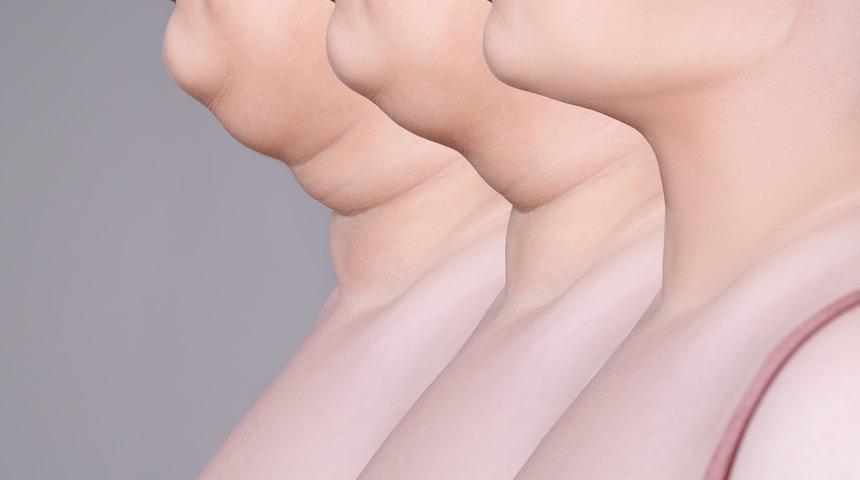 Estetik paranız cebinize kalsın! Gıdıyı tamamen eriten 4 hareket