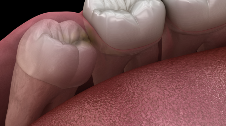 Dişler hakkındaki 5 şaşırtıcı ger&ccedil;ek