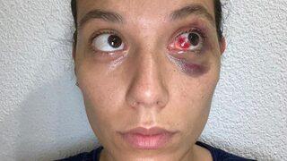 Deniz Bulutsuz'a da dava açıldı