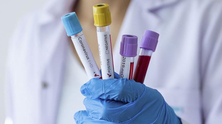 Galatasaray voleybol şubesinde 3 koronavirüs vakası