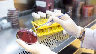 Dünya koronayı konuşuyor ama asıl tehlike kapıda: Bir çizik bile öldürebilir