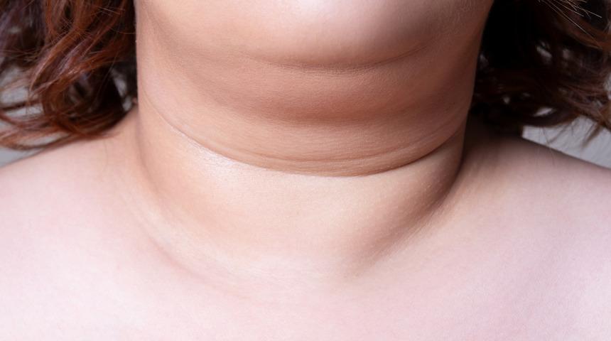 Venüs face: Gıdı azalıyor, çene belirginleşiyor!