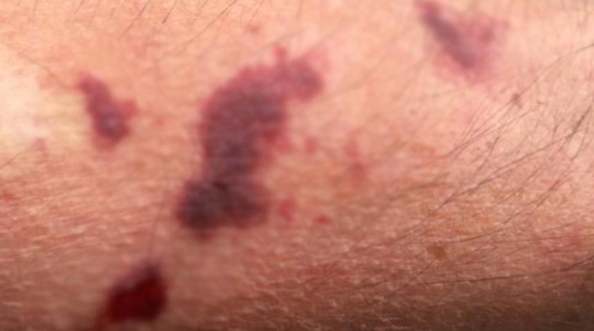 Vatandaşlarda 'Asya Kaplan'ı paniği! Yetkililerden yardım istediler