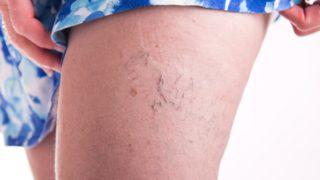 Sessiz ve sinsi ilerliyor! Varis, koronavirüs döneminde arttı