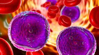 Ateş ve terlemeye dikkat! Lenfomada erken teşhis hayat kurtarıyor