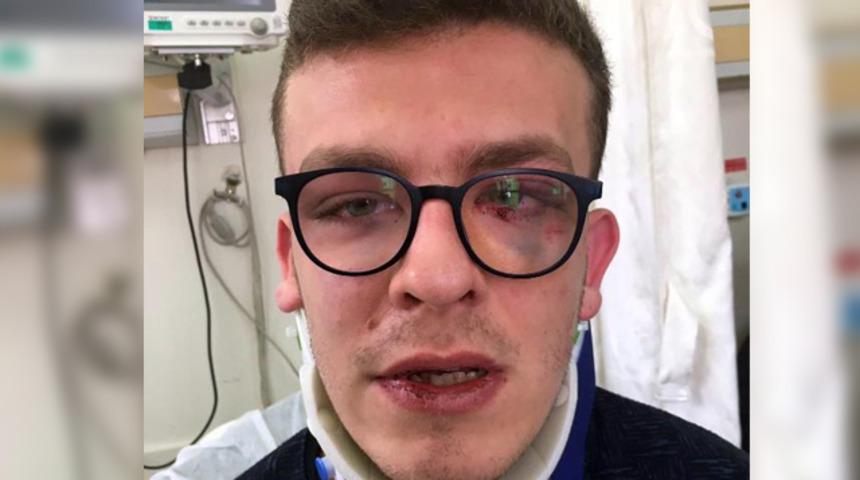 Avcılar'da otizmli gence dayak atan sanık hakkında karar verildi