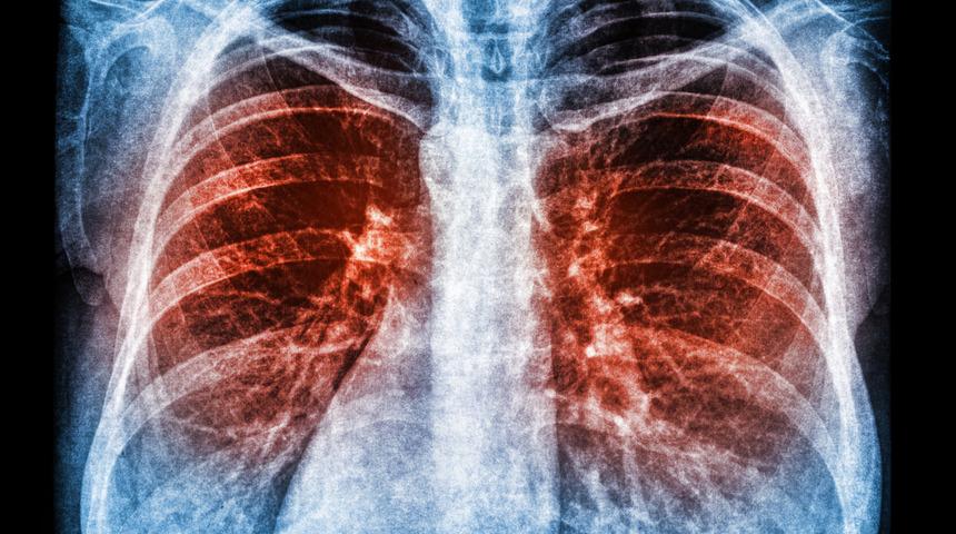 ABD&rsquo;li bilim insanları koronavir&uuml;s&uuml; etkisiz hale getiren protein buldu