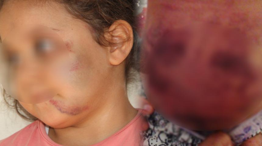 Şanlıurfa'da baba vahşeti! 2 g&uuml;n boyunca &ccedil;ocuklarına işkence yaptı